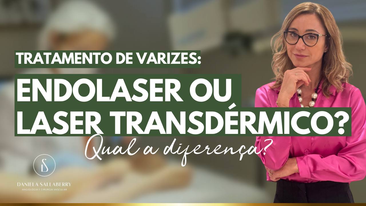 Tratamento de Varizes: Laser Transdérmico ou Endolaser? Qual a diferença?