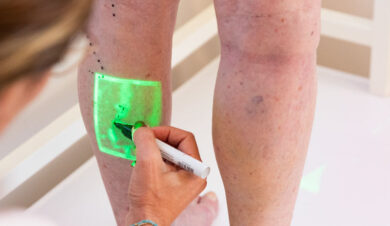 DSallaberry_Endolaser-20